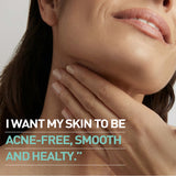 Bionnex Rensaderm Repairing & Sebum Control Cream For Oily & Acne-Prone Skin